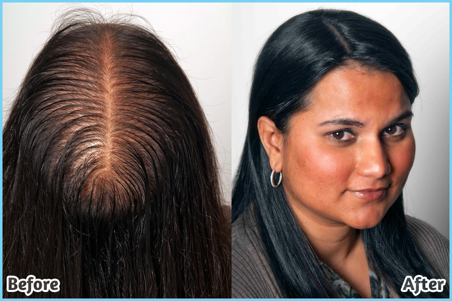 does aloe vera helps regrow hair